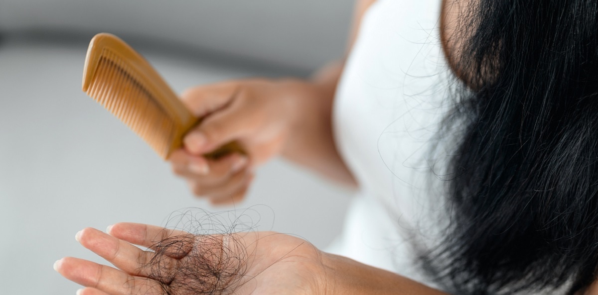 کدام ریزش مو خطرناک است؟