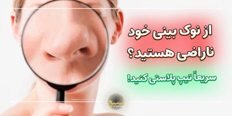 اگر از نوک بینی‌تان ناراضی هستید، تیپ پلاستی کنید!