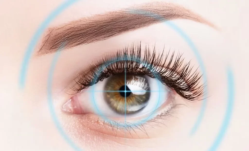 جایگزین لیزیک بدون برش
