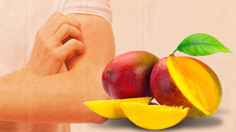 افراد دارای آلرژی غذایی
