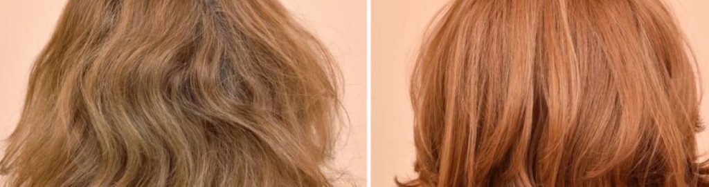 چه کسانی نباید پروتئین تراپی کنند؟