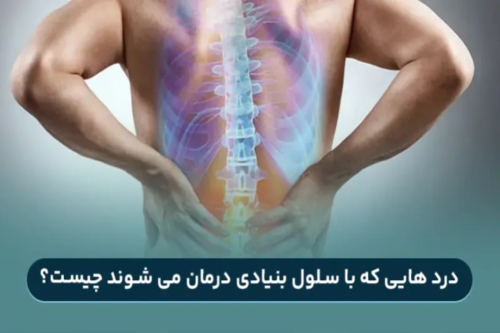 درد های قابل درمان با تزریق سلول بنیادی