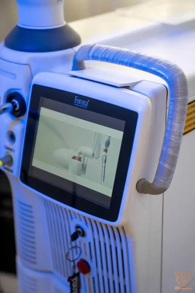 درمان ترک های پوستی با لیزر فوتونا در مشهد