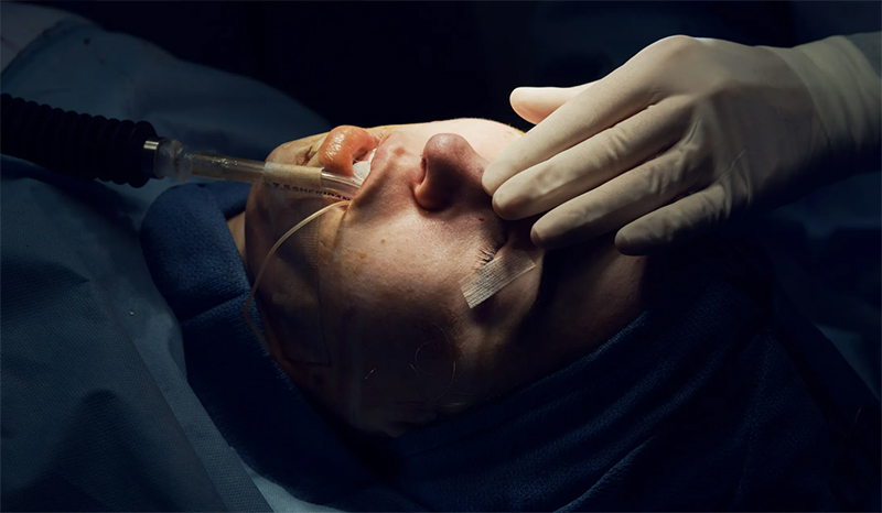 نکات جراحی بینی