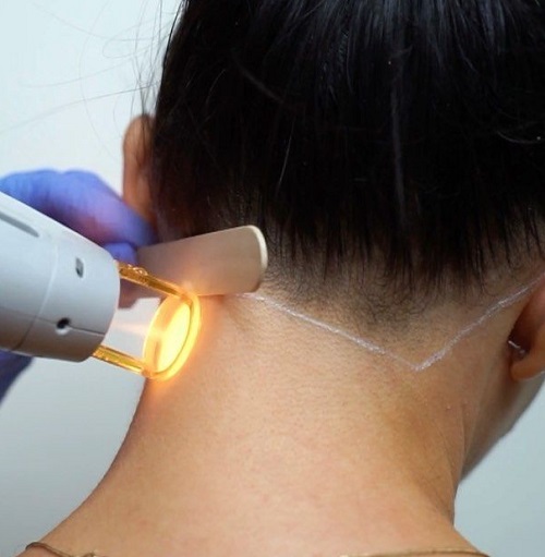 مزایای شغل اپراتور لیزر