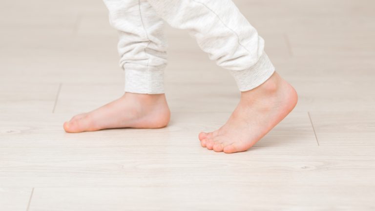 درمان کج گذاشتن پای کودک به بیرون