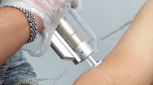 مدرک اپراتوری لیزر در اصفهان