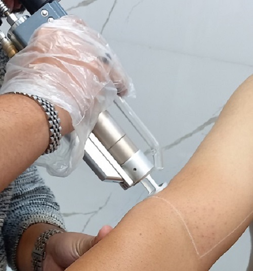 اپراتور لیزر