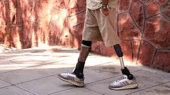 بهترین پای مصنوعی