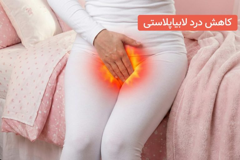 کاهش درد لابیاپلاستی