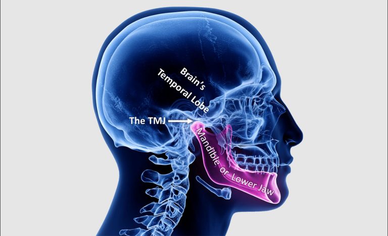 چرا موقع غذا خوردن فکم صدا میده؟ | علت‌ها و درمان‌های آن