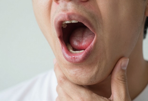 درمان عفونت گلو در بزرگسالان