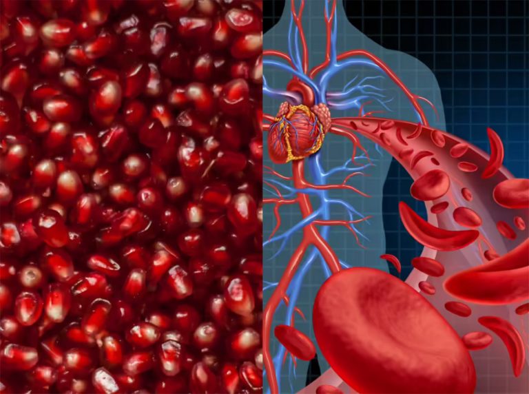 انار برای کم خونی؛ آیا انار واقعاً به درمان کم‌خونی فقر آهن کمک می‌کند؟