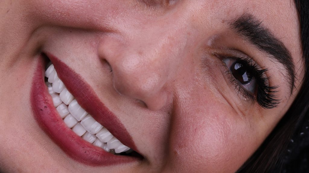 کامپوزیت دندان برای چه کسانی مناسب است؟