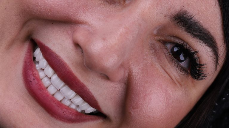 کامپوزیت دندان برای چه کسانی مناسب است؟