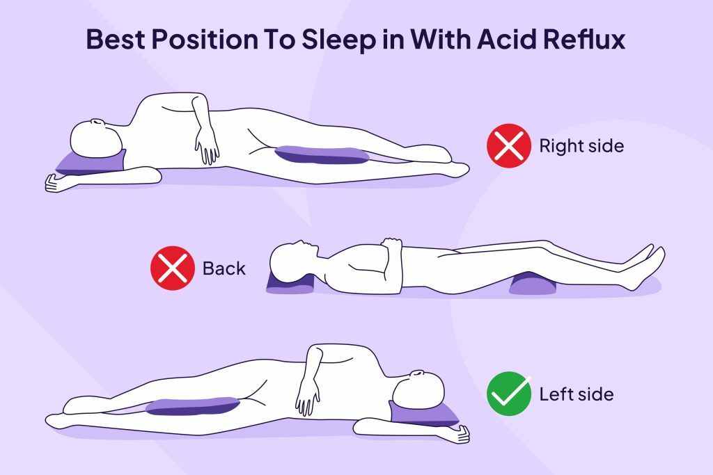خوابیدن بلافاصله بعد از سحری و اسید معده