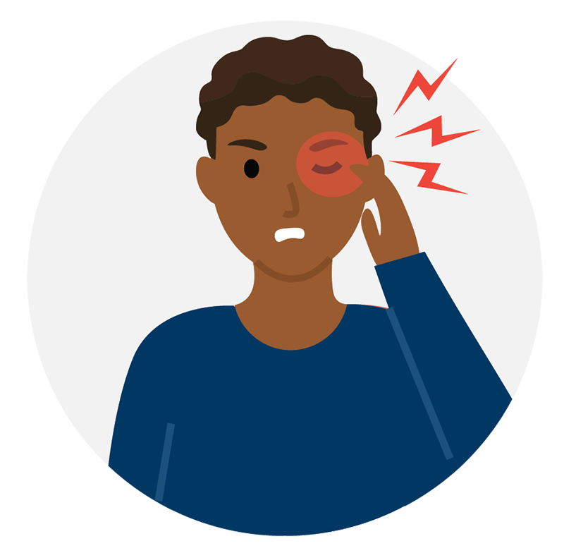 نقش سابقه میگرن در تشدید سردرد