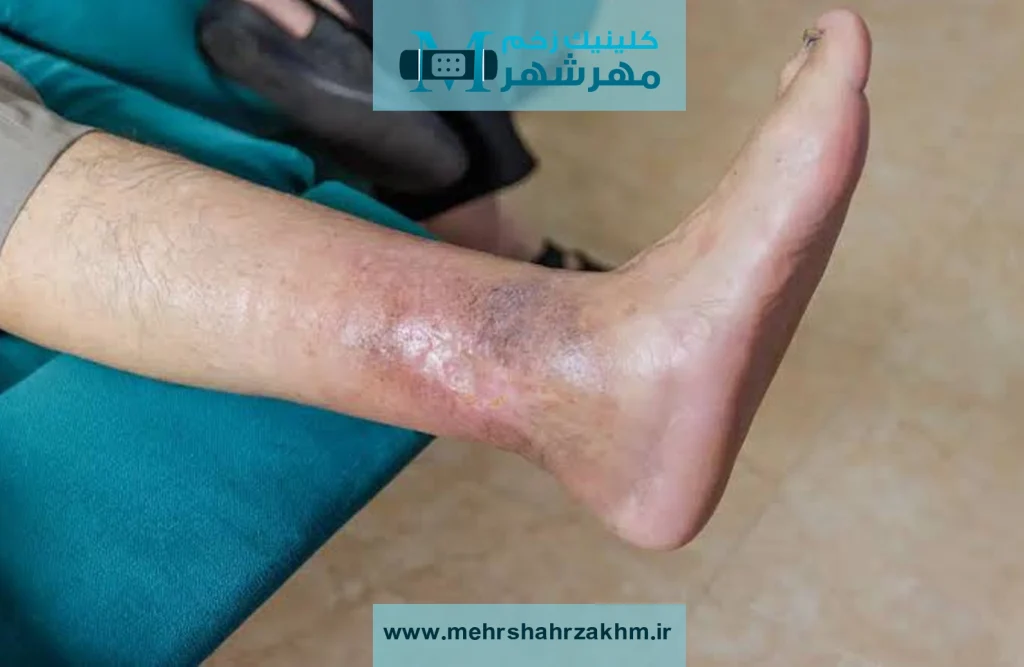 بدن برای ترمیم زخم چه مراحلی را طی می‌کند؟