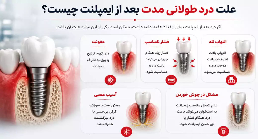 علت درد ایمپلنت بعد از چند سال