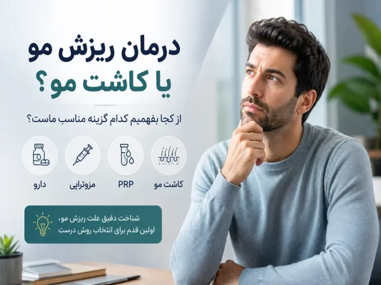 درمان ریزش مو یا کاشت مو