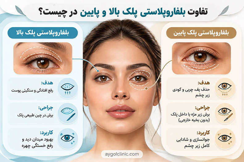 مقایسه انواع جراحی بلفاروپلاستی پلک بالا و پایین